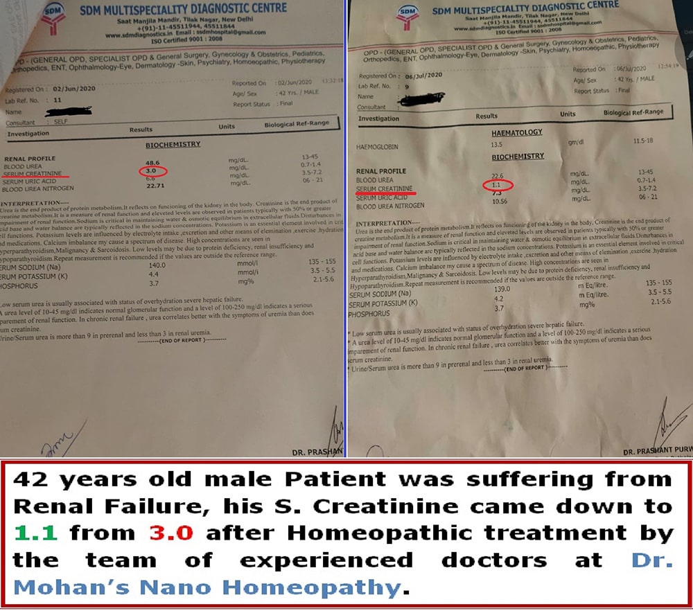 Dr. Mohan Singh Provide Best Kidney Failure Treatment in Nainital